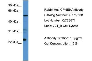 WB Suggested Anti-CPNE9  Antibody Titration: 0. (CPNE9 antibody  (C-Term))