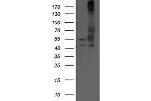 Image no. 1 for anti-Dihydrolipoamide Dehydrogenase (DLD) antibody (ABIN1497850) (DLD antibody)