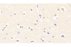 Detection of GTF2H5 in Human Cerebrum Tissue using Polyclonal Antibody to General Transcription Factor IIH, Polypeptide 5 (GTF2H5) (GTF2H5 antibody  (AA 1-71))