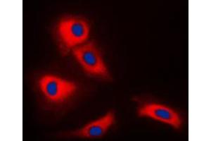 Immunofluorescent analysis of TRAF3 staining in HeLa cells. (TRAF3 antibody  (Center))