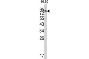 Western Blotting (WB) image for anti-Carboxypeptidase X (M14 Family), Member 2 (CPXM2) antibody (ABIN3002685) (CPXM2 antibody)