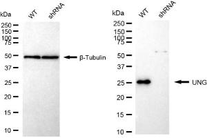 Western blotting analysis using UNG antibody (ABIN7800773). (Recombinant UNG antibody)