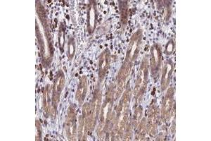 Immunohistochemical staining of human stomach with PPP1R26 polyclonal antibody  shows moderate cytoplasmic positivity in glandular cells. (PPP1R26 antibody)