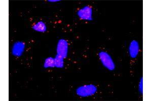 Proximity Ligation Analysis of protein-protein interactions between SPP1 and F2. (Osteopontin antibody  (AA 1-314))
