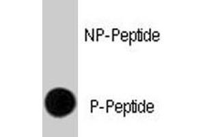 Dot blot analysis of ERBB2 (phospho Y1248) polyclonal antibody  on nitrocellulose membrane. (ErbB2/Her2 antibody  (pTyr1248))