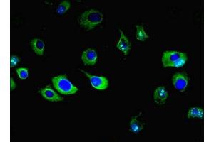 Immunofluorescent analysis of MCF-7 cells using ABIN7151390 at dilution of 1:100 and Alexa Fluor 488-congugated AffiniPure Goat Anti-Rabbit IgG(H+L) (ENPP6 antibody  (AA 31-330))