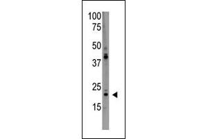 The anti-PD Antibody (C-term) (ABIN390190 and ABIN2840681) is used in Western blot to detect PD in HL60 lysate. (PDAP1 antibody  (C-Term))