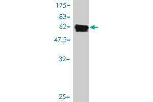 Western Blot detection against Immunogen (61. (PSMD7 antibody  (AA 1-324))