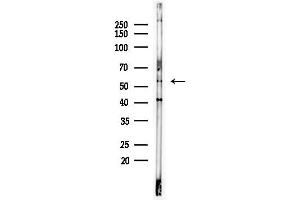 anti-Zinc Finger Protein 577 (ZNF577) antibody