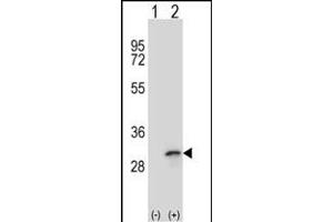 Western blot analysis of FHL1 (arrow) using rabbit polyclonal FHL1 Antibody (C-term) (ABIN390835 and ABIN2841061). (FHL1 antibody  (C-Term))