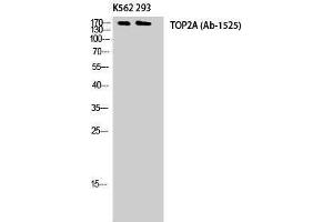 Western Blotting (WB) image for anti-Topo IIalpha (Tyr174) antibody (ABIN3177762) (Topo IIalpha (Tyr174) antibody)