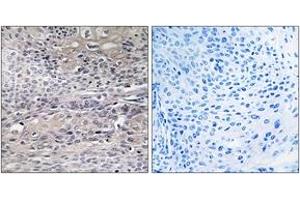 Immunohistochemistry analysis of paraffin-embedded human thyroid gland tissue, using IREB1 (Ab-711) Antibody. (Aconitase 1 antibody  (AA 681-730))