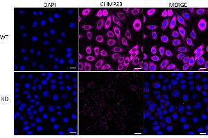 anti-Charged Multivesicular Body Protein 2B (CHMP2B) antibody