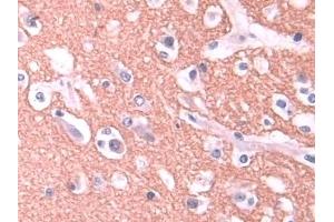 Detection of STX1A in Human Cerebrum Tissue using Polyclonal Antibody to Syntaxin 1A, Brain (STX1A) (STX1A antibody  (AA 1-255))