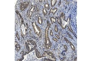 IHC analysis of SMAD2 using anti-SMAD2 antibody (ABIN7602542).