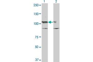 Western Blot analysis of KIT expression in transfected 293T cell line by KIT monoclonal antibody (M10), clone x1. (KIT antibody  (AA 41-140))
