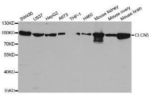 Western blot analysis of extracts of various cell lines, using CLCN5 antibody. (Chloride Channel 5 antibody  (AA 637-816))