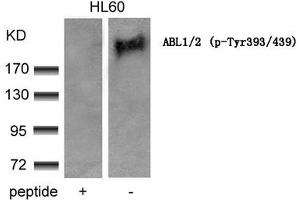 ABL1/2 antibody  (pTyr393, pTyr439)