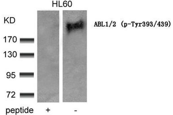 ABL1/2 antibody  (pTyr393, pTyr439)