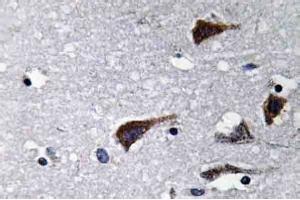 Immunohistochemistry analysis of Cathepsin B Antibody in Paraffin-Embedded Human brain tissue. (Cathepsin B antibody)
