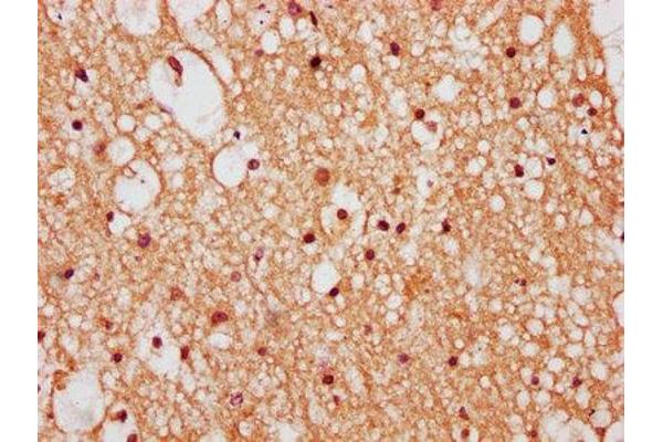 ZNF282 antibody  (AA 240-384)