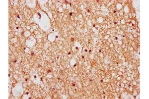IHC image of ABIN7176211 diluted at 1:400 and staining in paraffin-embedded human brain tissue performed on a Leica BondTM system. (ZNF282 antibody  (AA 240-384))