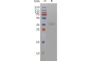 Mouse A Protein, His Tag on SDS-PAGE under reducing condition.