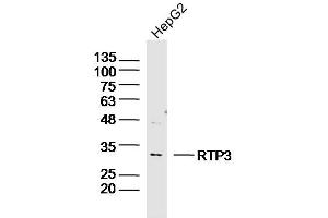 Human HepG2 lysates probed with RTP3 Polyclonal Antibody, Unconjugated  at 1:300 dilution and 4˚C overnight incubation. (RTP3 antibody  (AA 21-120))