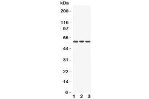 Western blot testing of Dopamine Receptor D5 antibody and Lane 1:  rat brain;  2: mouse brain;  3: human U87 cell lysate.