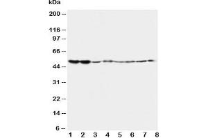 Western blot testing of 5HT2A Receptor antibody and Lane 1:  rat brain;  2: rat brain;  3: mouse brain;  4: mouse brain and human samples  5: U87;  6: SMMC-7721;  7: HT1080;  8: COLO320 (HTR2A antibody  (C-Term))