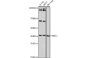 Western blot analysis of extracts of various cell lines, using NEIL1 antibody (ABIN6130579, ABIN6144514, ABIN6144515 and ABIN6221523) at 1:1000 dilution.