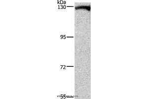 Western blot analysis of Human testis tissue, using DAAM1 Polyclonal Antibody at dilution of 1:400 (DAAM1 antibody)