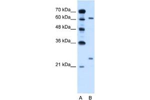 WB Suggested Anti-RORA Antibody Titration:  0.
