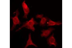 Immunofluorescence (fixed cells) (IF/ICC) image for anti-Cadherin 18, Type 2 (CDH18) (N-Term) antibody (ABIN6257588)