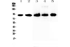 Western blot analysis of CD44 using anti-CD44 antibody . (CD44 antibody  (AA 21-259))