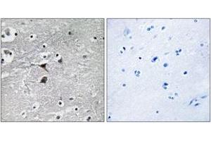 Immunohistochemistry analysis of paraffin-embedded human brain tissue, using Tryptophan Hydroxylase (Ab-260) Antibody. (Tryptophan Hydroxylase 1 antibody  (AA 231-280))