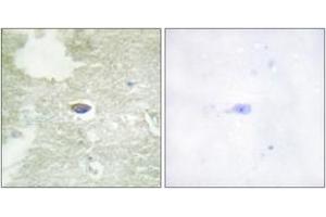 Immunohistochemistry analysis of paraffin-embedded human brain, using TGF beta Receptor II (Phospho-Ser225/250) Antibody.