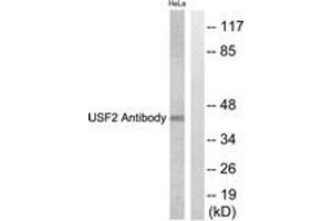 Western blot analysis of extracts from HeLa cells, using USF2 Antibody. (USF2 antibody  (AA 196-245))