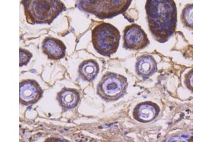 Paraformaldehyde-fixed, paraffin embedded mouse skin, Antigen retrieval by boiling in sodium citrate buffer (pH6) for 15min, Block endogenous peroxidase by 3% hydrogen peroxide for 30 minutes, Blocking buffer at 37°C for 20min, Antibody incubation with Cytochrome C (1F10) Monoclonal Antibody  at 1:50 overnight at 4°C, followed by a conjugated secondary and DAB staining. (Cytochrome C antibody)