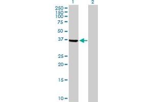 Western Blot analysis of TSSK2 expression in transfected 293T cell line by TSSK2 MaxPab polyclonal antibody. (TSSK2 antibody  (AA 1-358))