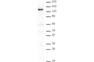 PARP-1 N-terminal antibody tested by Western blot. (PARP1 antibody  (N-Term))