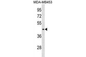 Western Blotting (WB) image for anti-Asparagine-Linked Glycosylation 8, alpha-1,3-Glucosyltransferase Homolog (ALG8) antibody (ABIN3000312) (ALG8 antibody)
