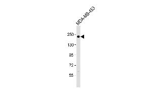 Anti ERBB2 Antibody  at 1:500 dilution + MDA-MB-453 whole cell lysate Lysates/proteins at 20 μg per lane. (ErbB2/Her2 antibody  (AA 706-735))