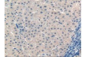IHC-P analysis of Human Liver Tissue, with DAB staining. (Retinol Binding Protein 5 antibody  (AA 2-135))