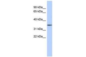 Image no. 1 for anti-F-Box Protein 31 (FBXO31) (AA 431-480) antibody (ABIN6743760) (FBXO31 antibody  (AA 431-480))