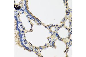 Immunohistochemistry of paraffin-embedded rat lung using IL36G antibody at dilution of 1:100 (40x lens).