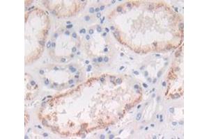 IHC-P analysis of Human Tissue, with DAB staining. (IL1A antibody  (AA 113-271))