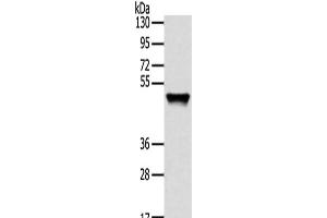 Western Blot analysis of Human fetal liver tissue using TRIM14 Polyclonal Antibody at dilution of 1/800 (TRIM14 antibody)