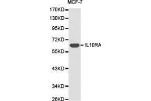 Western Blotting (WB) image for anti-Interleukin 10 Receptor, alpha (IL10RA) antibody (ABIN1873185) (IL-10RA antibody)