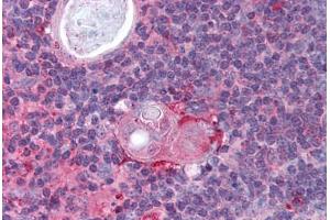 Human Thymus (formalin-fixed, paraffin-embedded) stained with IKBKB antibody ABIN297183 at 2. (IKBKB antibody  (AA 310-376))